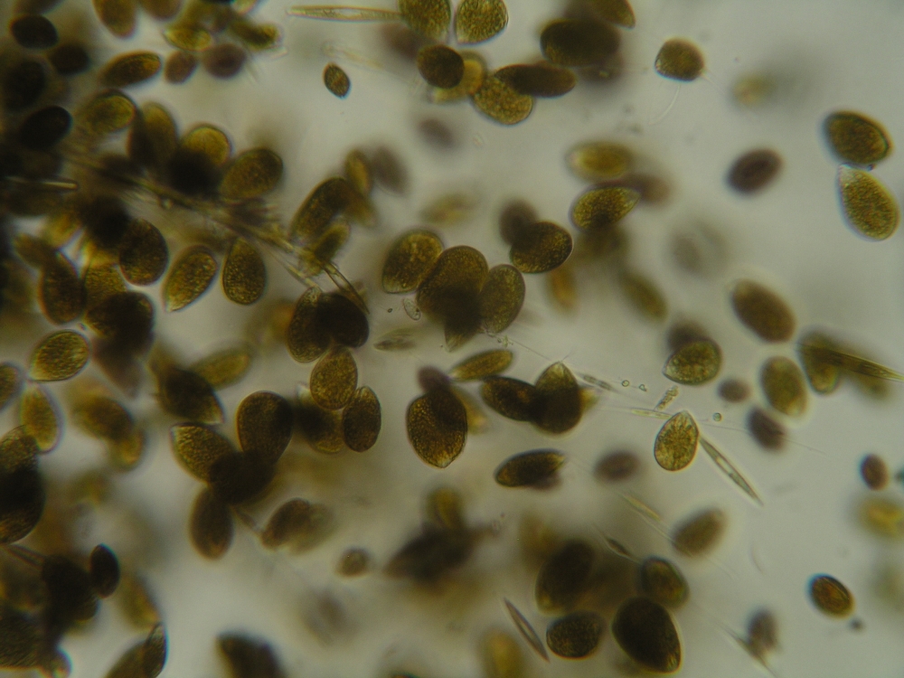 Numerose cellule di Ostreopsis ovata