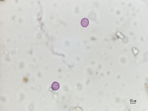 poline di Brussonetia al microscopio