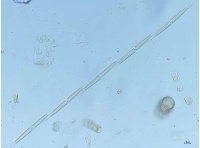 5 cellule di Pseudonitzschia sp.p. in catena