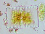 Cellula di Striatella unipunctata con cloroplasti stellati