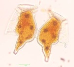 Due cellule di Dinophysis caudata appena divise