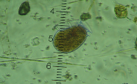 Dinophysis fortii
