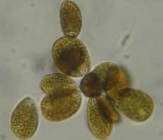 Cellule di Ostreopsis cfr. ovata al microscopio ottico